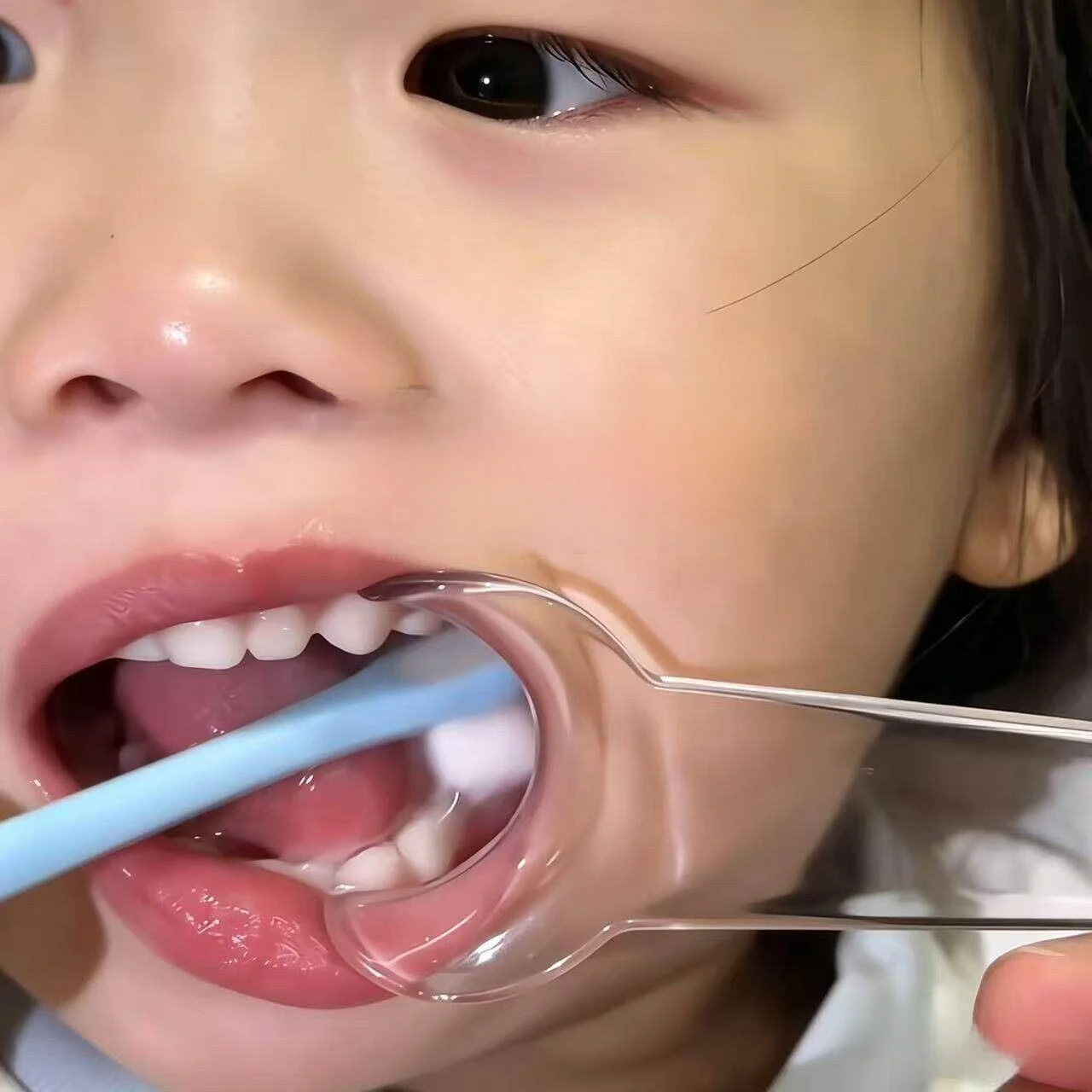 Baby Toothbrushing Tool Child Oral Opening Device Assisted Cleaning Small Device for Teeth Dirt Cleaning Home Daily Use