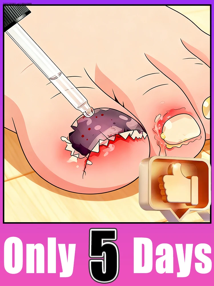 Bʀᴇᴀᴋ ғʀᴇᴇ ғʀᴏᴍ ᴅʀʏ ᴄʀᴀᴄᴋᴇᴅ ᴄᴜᴛɪᴄʟᴇs, ᴋᴇᴇᴘ ғɪɴɢᴇʀᴛɪᴘs sᴏғᴛ ᴀɴᴅ ɴᴏᴜʀɪsʜᴇᴅ