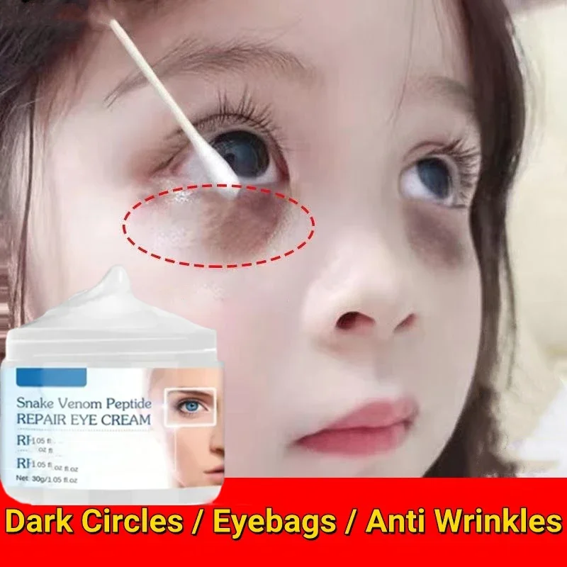 7 Day Tighten Wrinkles Eye Cream Anti Dark Circles Bags Puffiness Fade Eye Fine Line Whiten Under Eyes Skin Korean Care New 2024