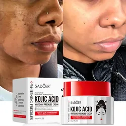 Kojic Acid Cream Remove Pigment Melanin Whitening Remove Dark Spots Cream Nourishing Brighten Moisturizing Skin Care Face Cream