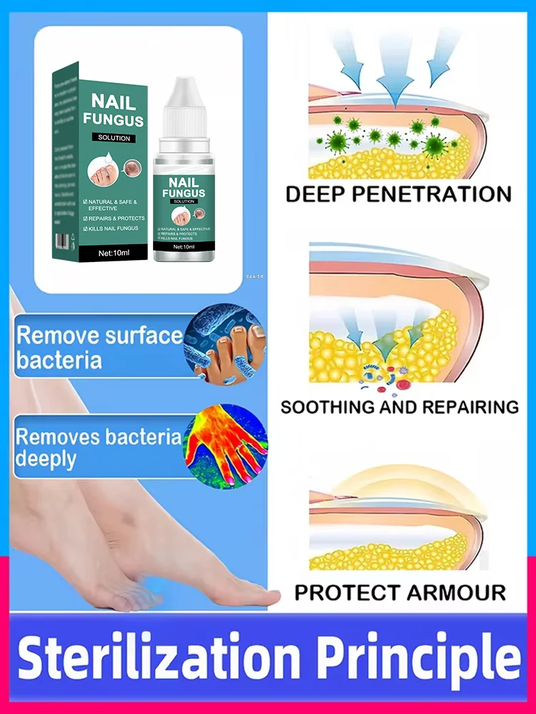 2025 يستحق الاستثمار في 100% معالجة فطريات الأظافر 5 أيام #4