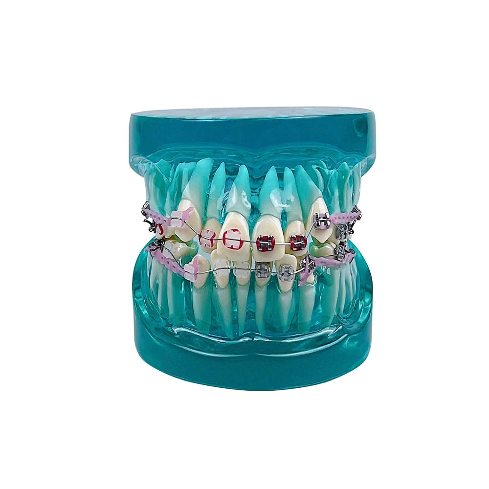 Orthodontic Dental Treatment Teeth Model Teaching Study Gum Tooth Models With Ortho Metal Bracket Arch Wire Ligature Ties Dentis