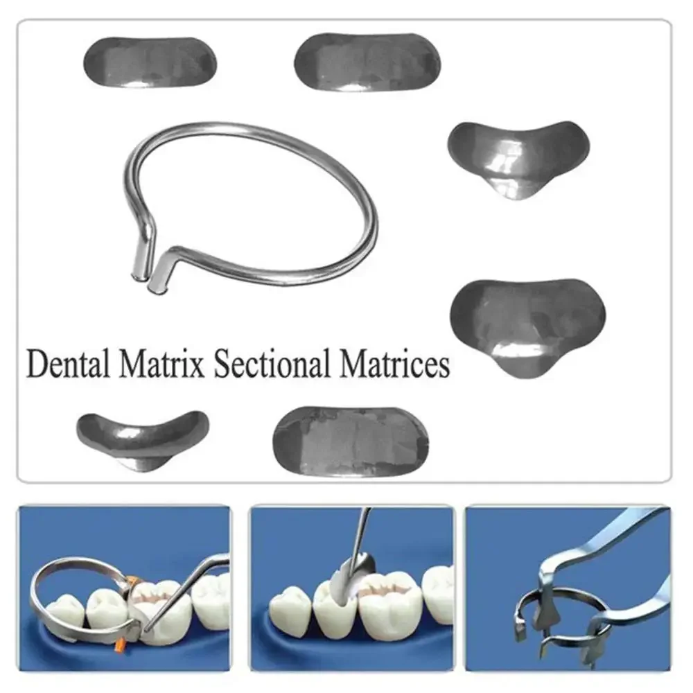 Dental Posterior Restoration Kit 100Pcs Sectional Matrix Bands 2 Rings Forming Clips Size 35 No 1 398 Composite Filling