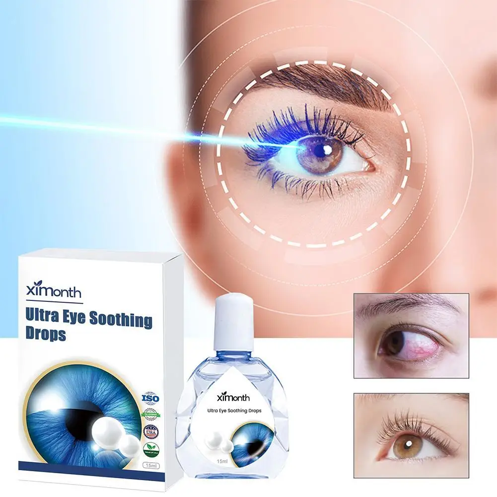 15ml Eyesight Improvement High Quality Eye Drops Relieve Blurred Vision Clean Drop Eyes Detox Discomfort Dry Itchy Liquid