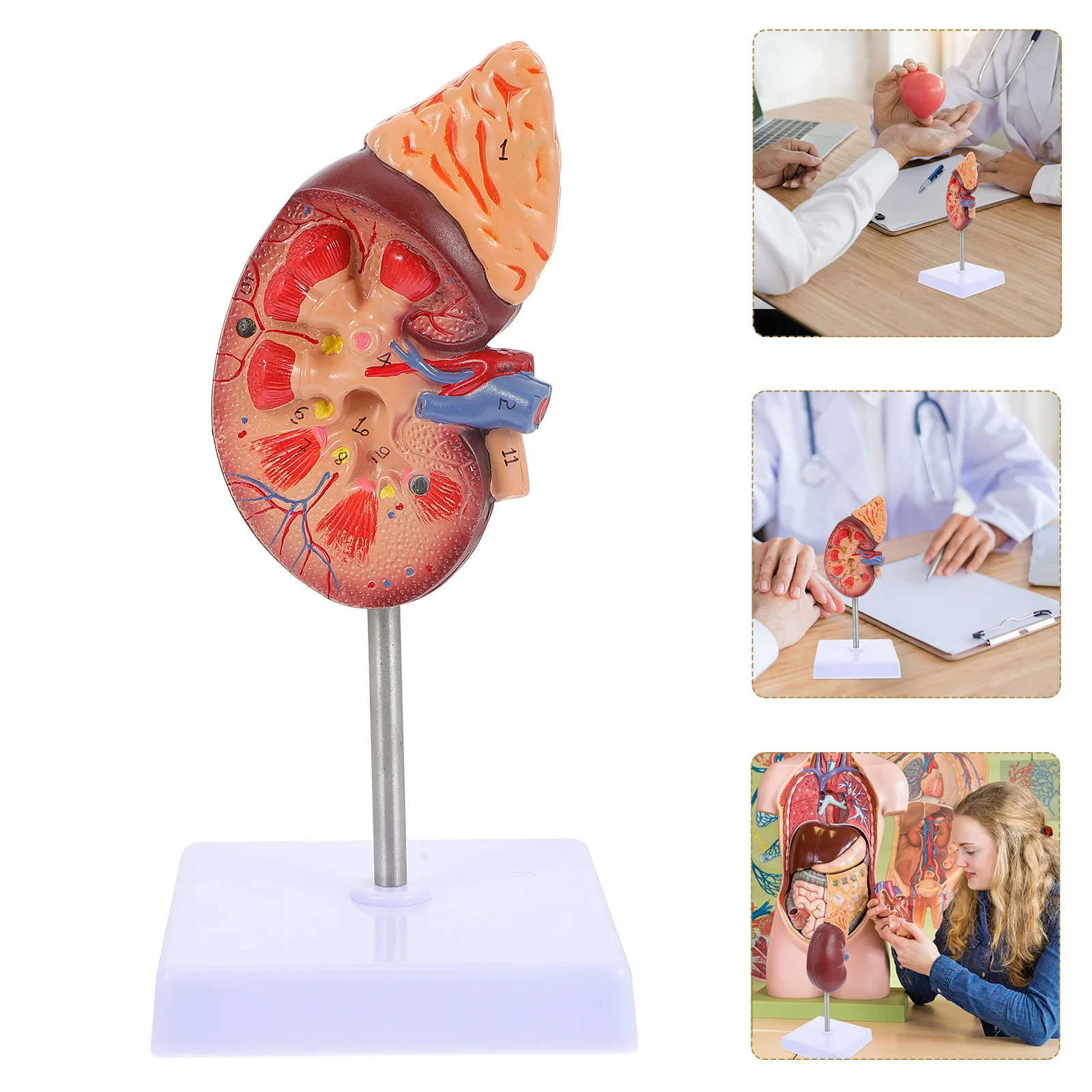 Models Kidney Biology Demonstration Anatomical Pillar Human Prop Class Accessory Body