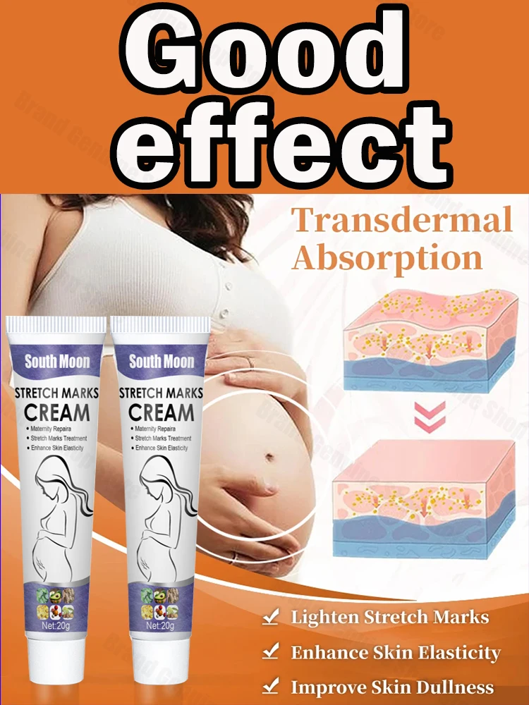 

Eliminate Red White Old Stretch Marks Cream For Pregnancy