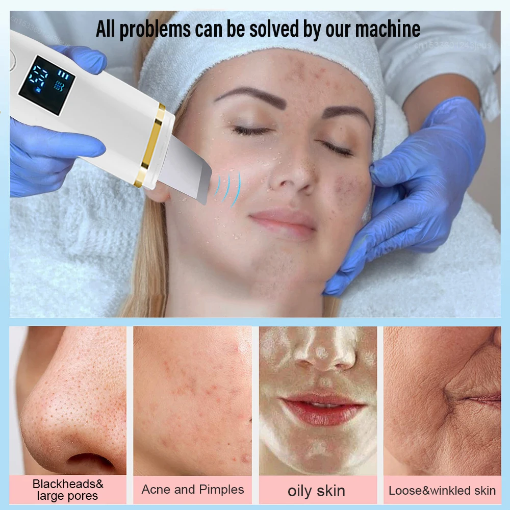 Ultrasonic Skin Scrubber Facial Peeling Blackhead Remover Deep Face Cleaning Pore Spatula Ultrasonic Face Cleaning Skin Scrubber