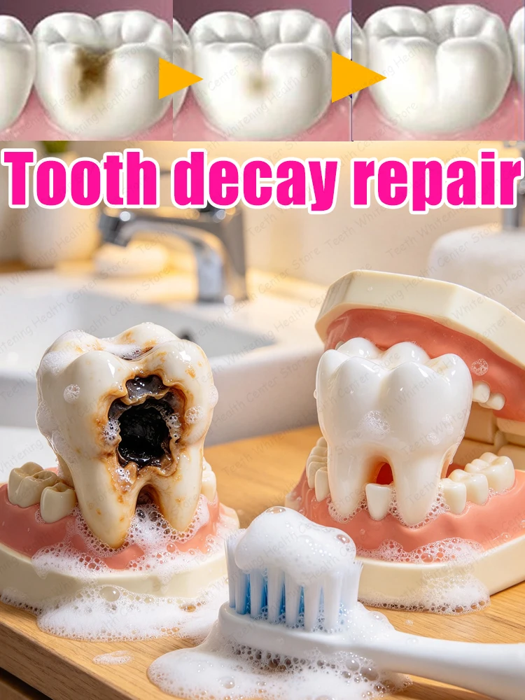 Enamel Repair Toothpaste Prevent Caries Deep Clean