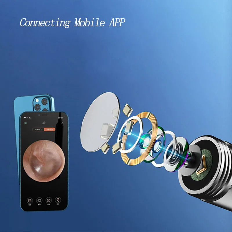 Smart Wireless Ear Wax Removal Tool - LED Light Ear Cleaner Camera for Adults & Kids HD Visual Ear Pick Scoop Hygienic