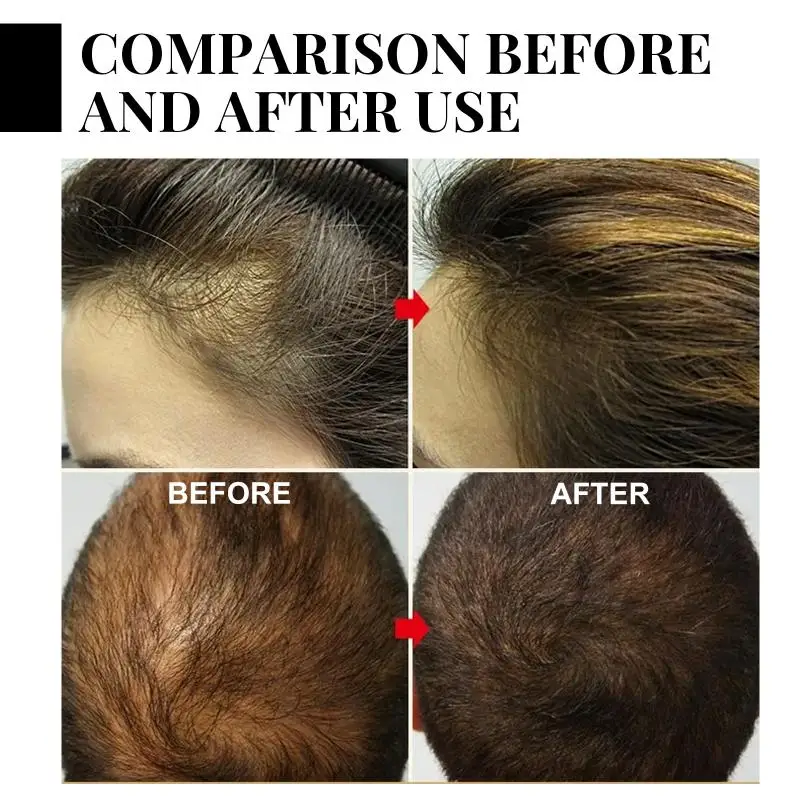 Batana Hair Regrowth Serum Anti-Hair Loss Deeply Nourishing Strengthening Roots Keep Soft Repair Damaged Dry Hair Scalp Care Oil