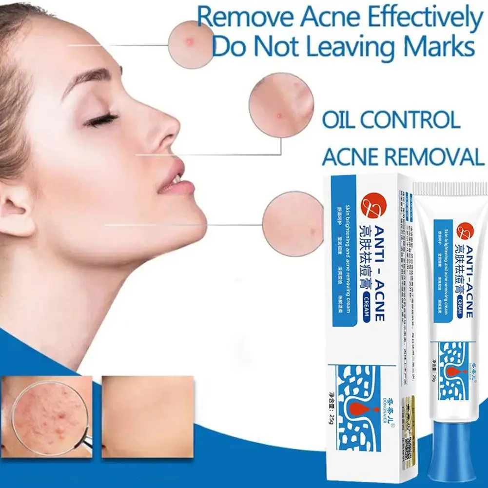 Effective Acne Treatment Cream Anti Blackheads Acne Moisturizing Beauty Products Spots Pores Brighten Shrink Care Smooth Sk Z6K0