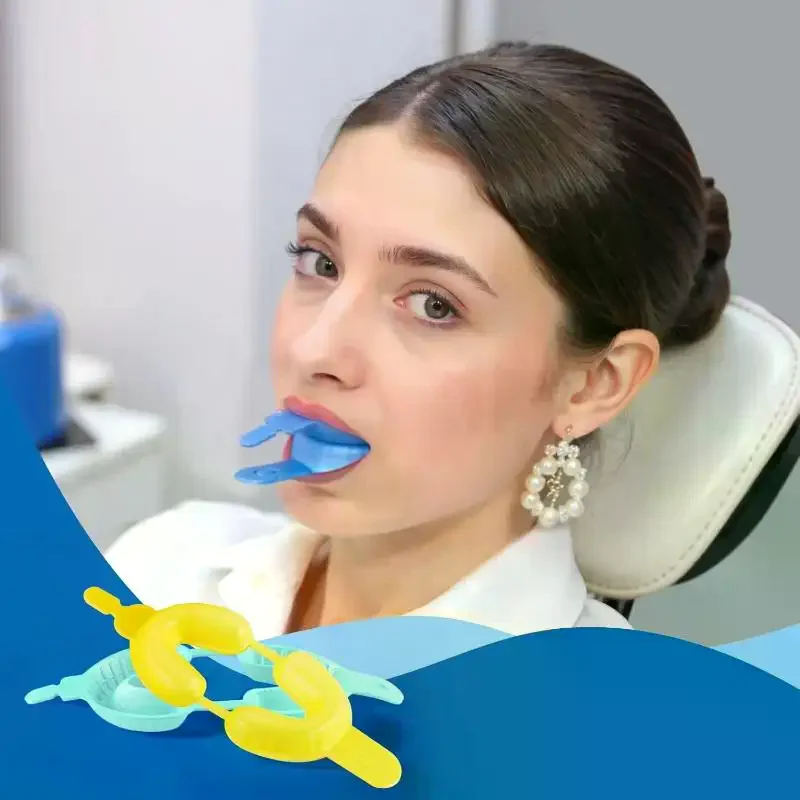 50Pcs/Bag Dental Disposable Fluoride Foam Impression Trays Skin-Friendly Smooth Dentistry Tool for Oral Examination