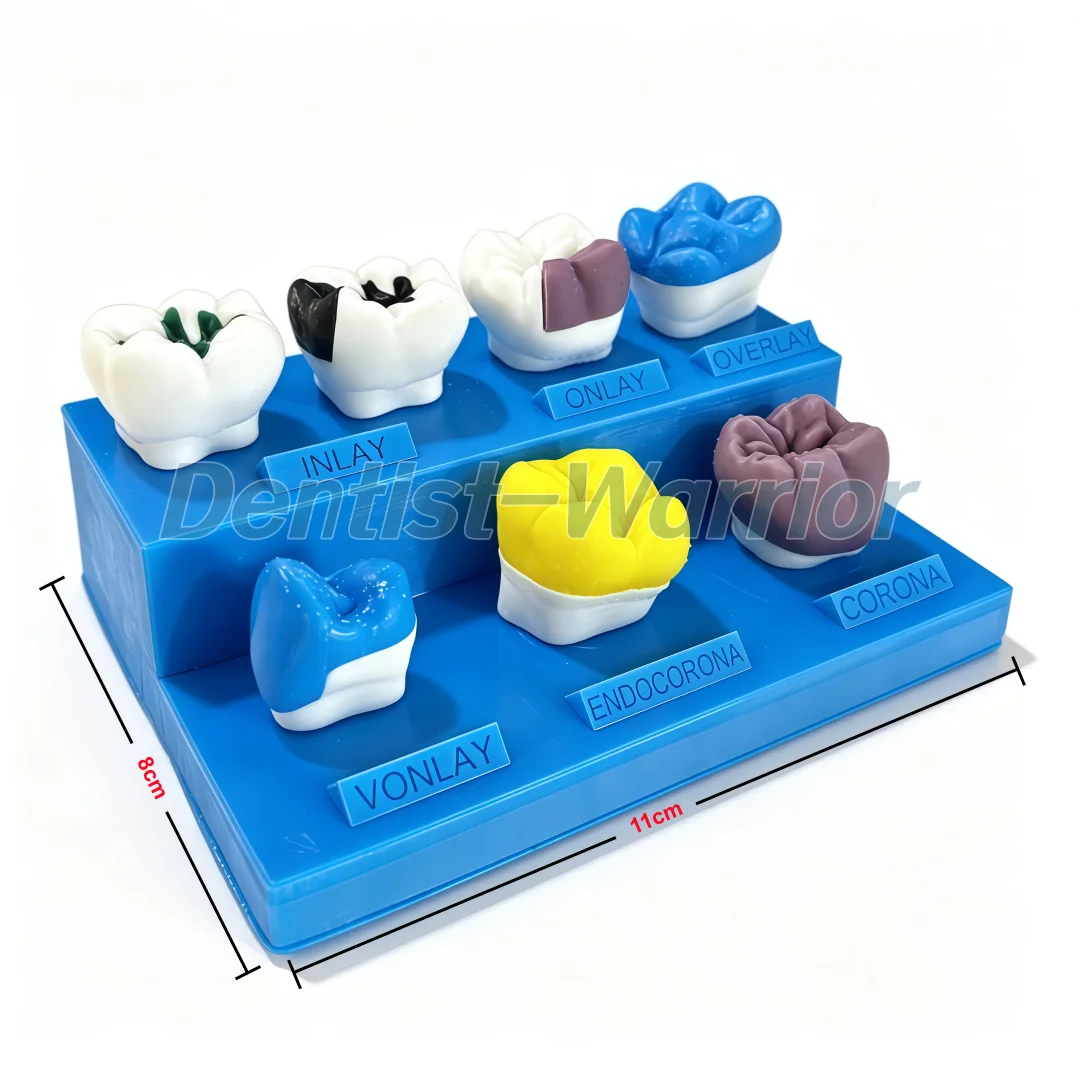 7 Tipos de Modelo Didático de - 3D Printing Dental avaliação e preço