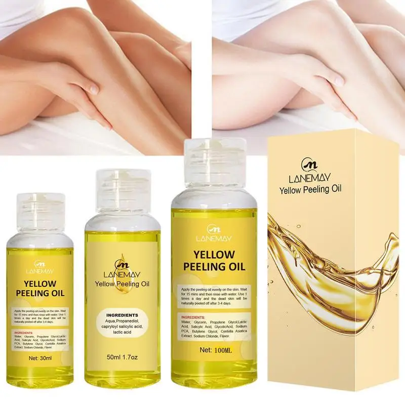 NEW 30/50/100ml Yellow Peeling Oil Exfoliating Bleaching Dark Skin Spots Knee Finger Remove Dead Skin Brighten Body Skin Care