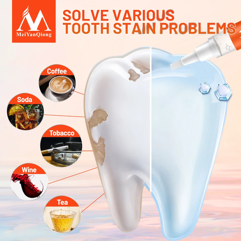 MeiYanQiong Очищение полости рта Отбеливающая эссенция для зубов эффективно удаляет зубной камень Чистка зубов Гигиена полости рта Стоматологические инструменты Уход за полостью рта