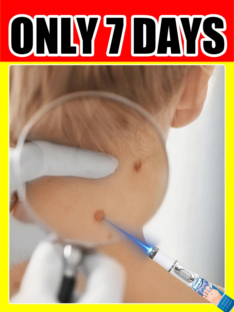 Hot selling blue light pen to solve body warts, wart care tools