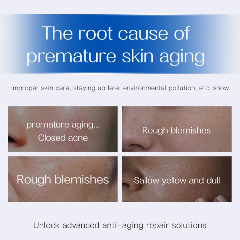 100 مللي GONGPEI فيتامين C مصل تبييض ترطيب المضادة للتجاعيد حمض الساليسيليك مكافحة حب الشباب الوجه جوهر الكورية جهاز العناية بالوجه #4