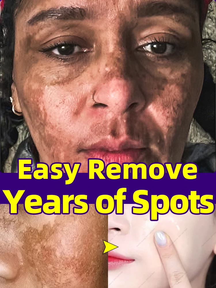 

Solve all your dark spots problem