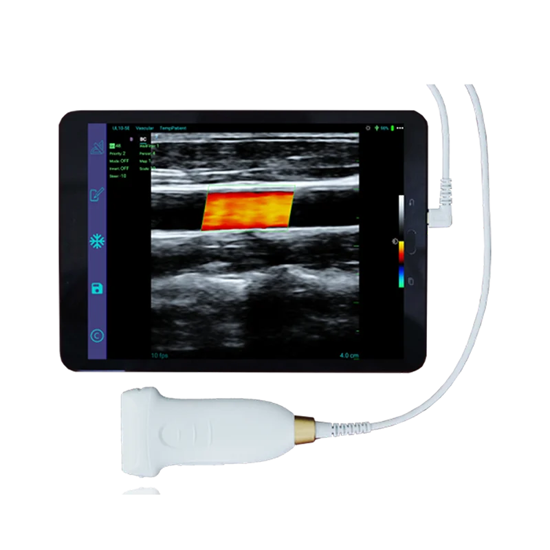 

Amain Medical supplies MagiQ MCUL10-5E handheld Color Doppler and CE Certification linear probe ultrasound