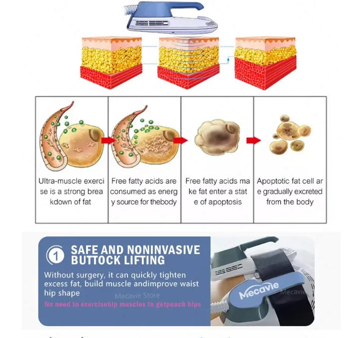 آلة العضلات MECAVIE 6500W Neo 15 Hi EMT - 4 مقابض لوحة تحفيز الحوض اختيارية - معدات اللياقة البدنية لتدريب العضلات #2