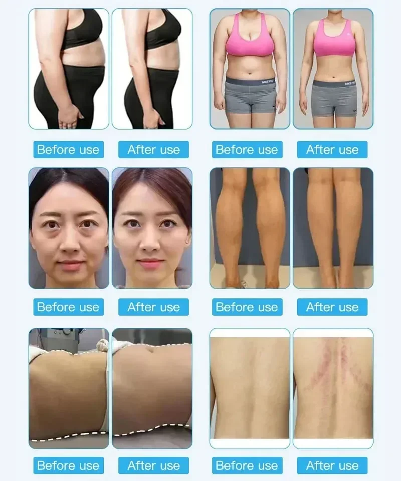 6 in 1 80K fit burner cavitation machine weight loss body slimming cavitation machine 80kPopular