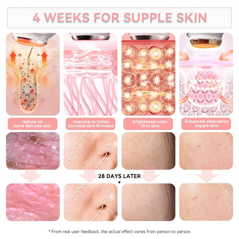 جهاز تجميل الوجه والرقبة من Smart Library Home High Wand للعناية بالعين ومضاد للشيخوخة #6