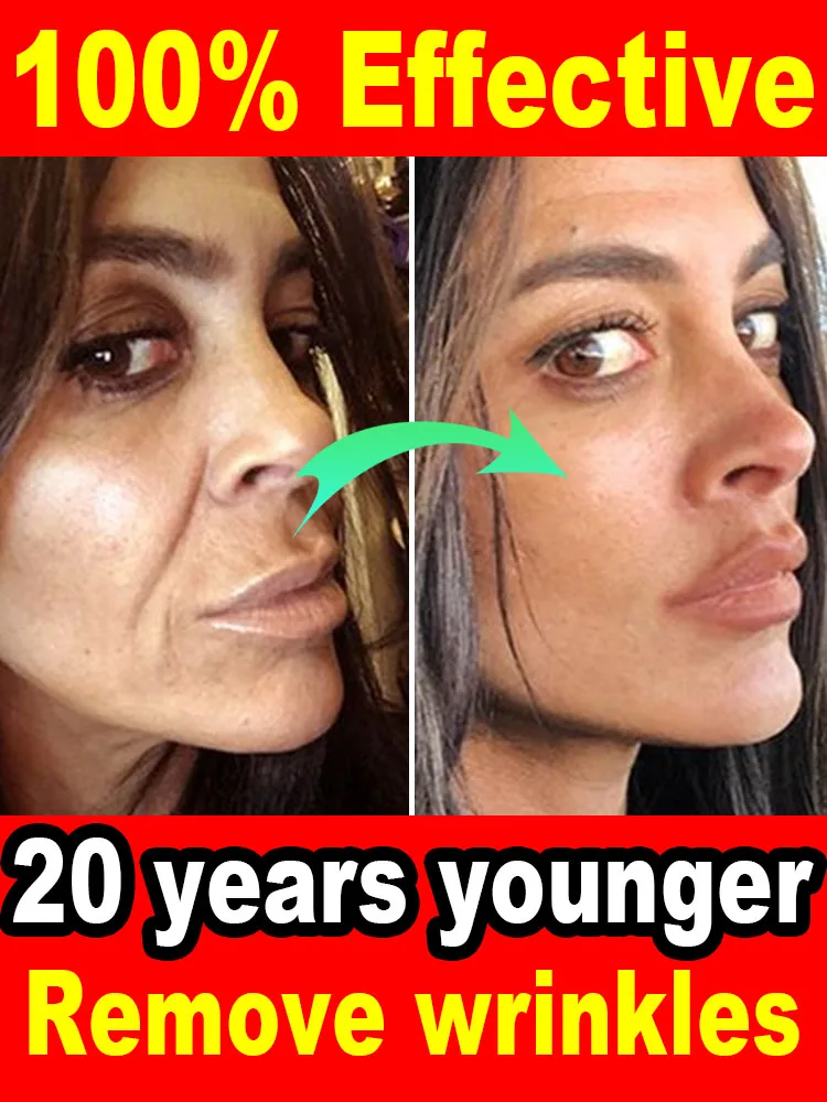 

Wrinkles disappear Become beautiful now