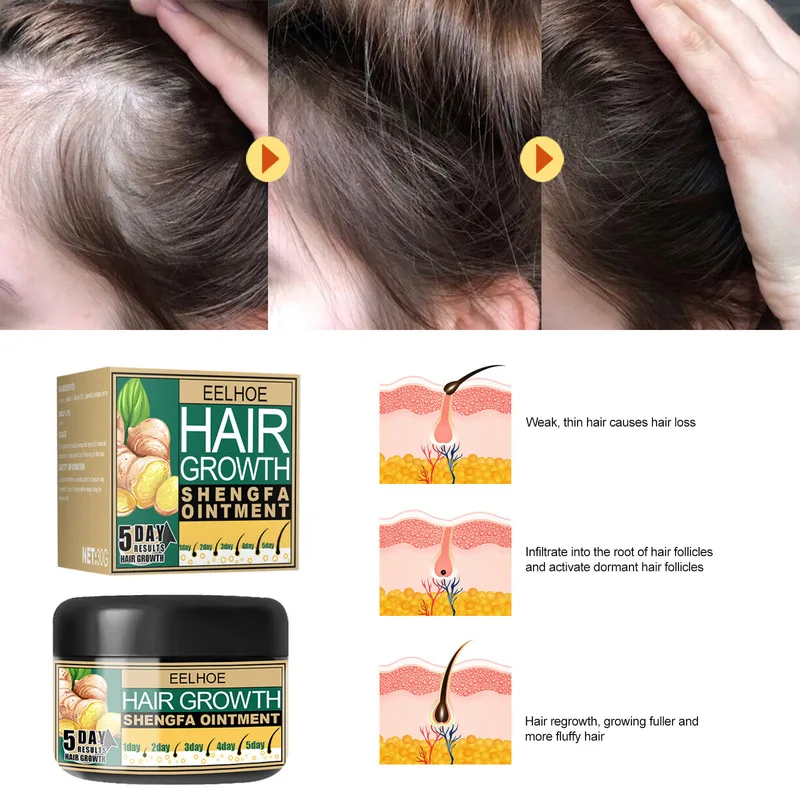 Hair Growth Essential Oils Hair Fast Grow Cream Prevent Hair Loss Repair Damaged Thinning Beauty Men Women Scalp Treatments 30g