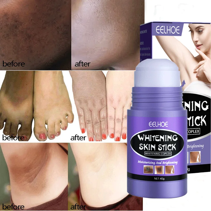 Armpit Whitening Cream Private Parts Dark Skin Bleaching Lighten Melanin  Nipple Brighten Thigh Whiten Butt Knee Stick Skin Care