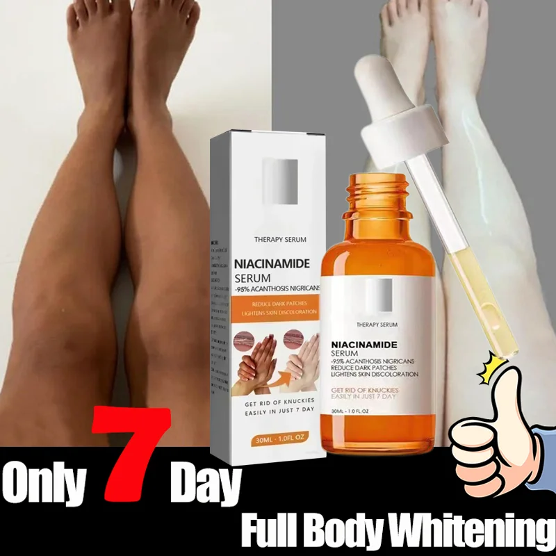 

Отбеливающая сыворотка для темных костяшек пальцев, локтей, подмышек, пляжная сыворотка, сильная отбеливающая сыворотка для темных костяшек пальцев, женская интимная часть кожи, удаление кожи