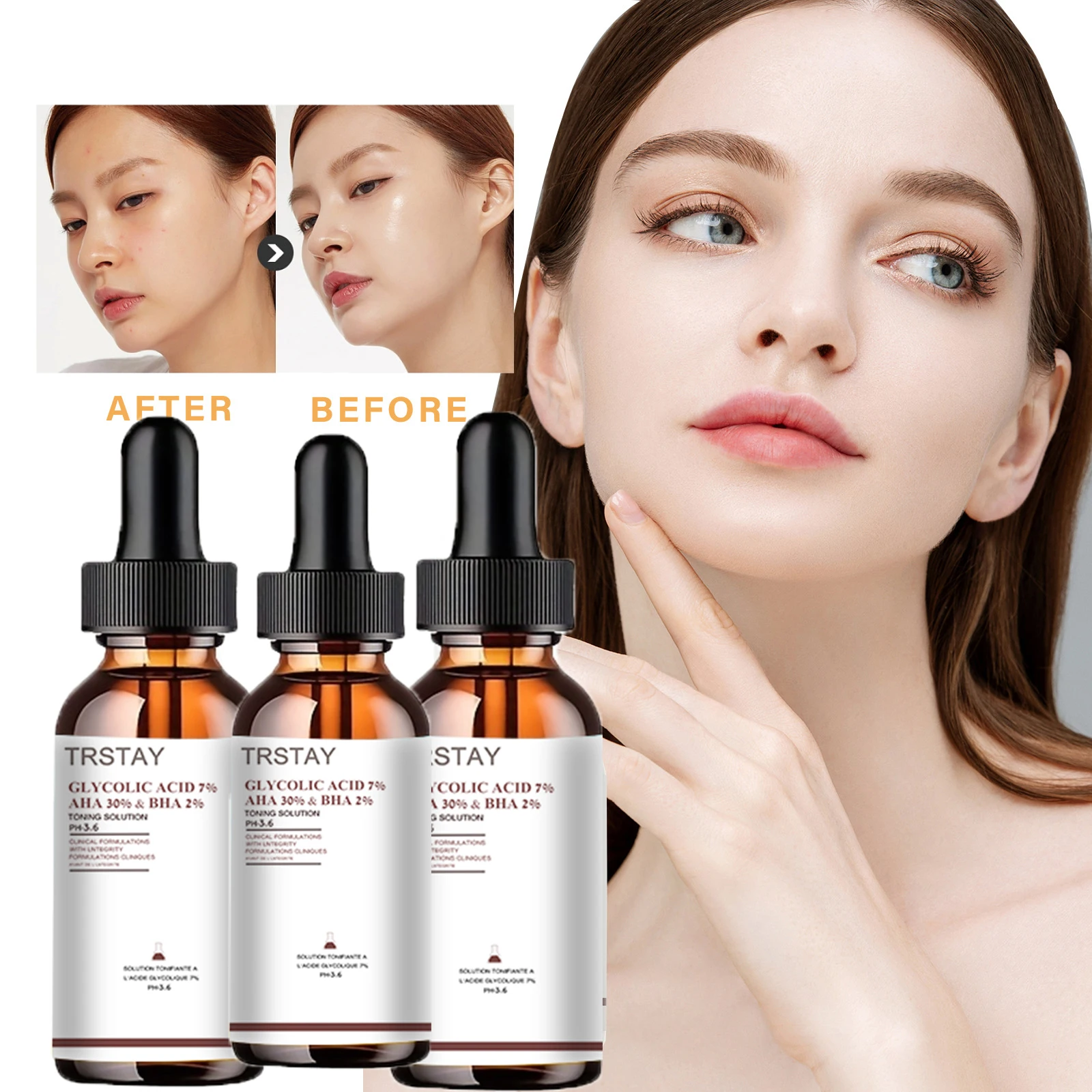 GLYCOLIC ACID REMOVE SKIN CUTIN AND ACNE