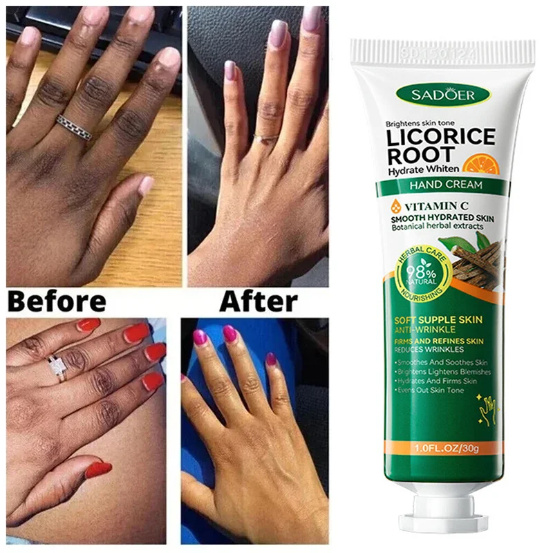 Moisturizing Intense Stains Remover Melanin Hand Cream Corrector Fast Whitening Dark Knuckles Brighten Products hand Skin Care