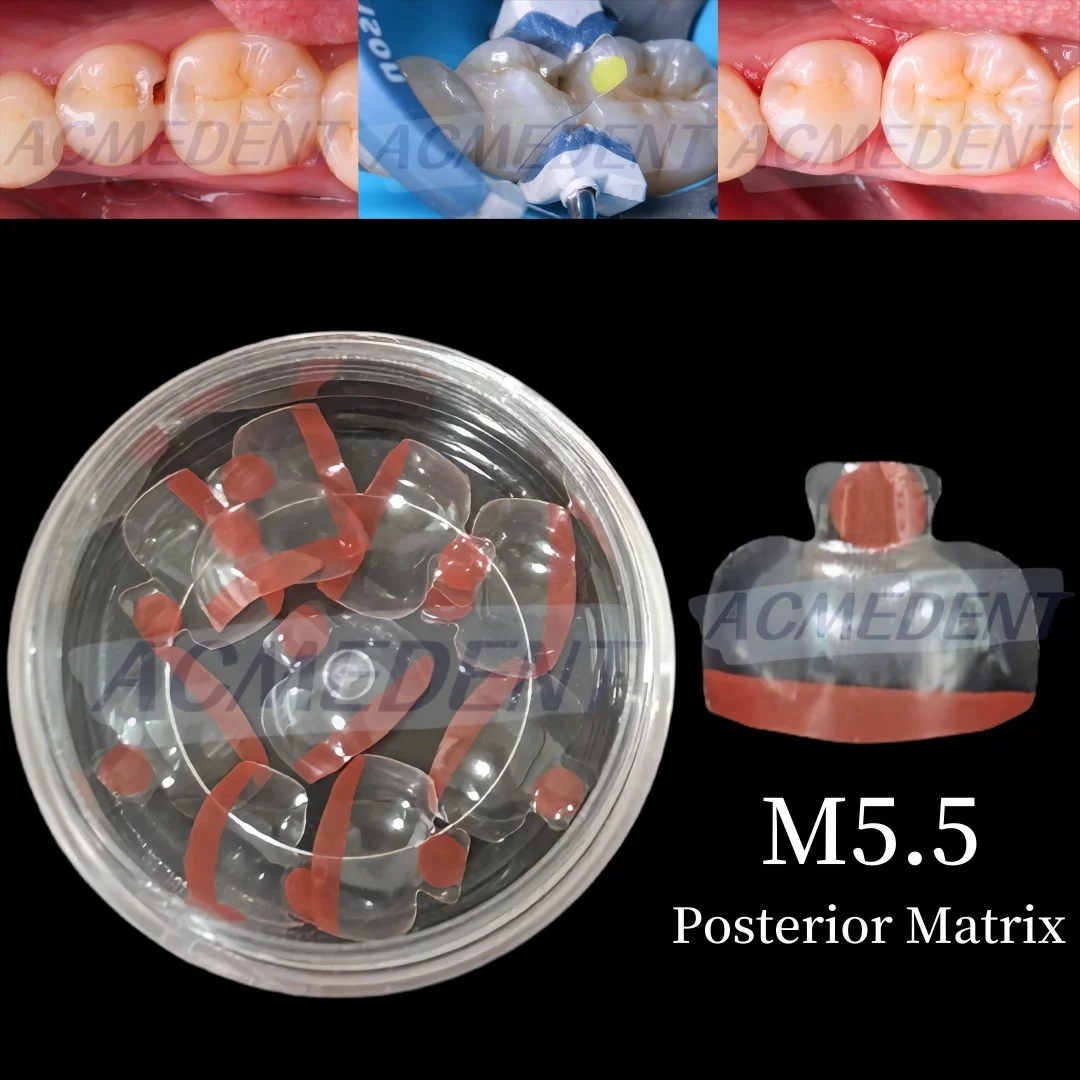 

Прозрачная матрица M5.5, стоматологические, задние, прозрачные матрицы BT Maxillary, контурные, аналог BioClear Matrice, черный треугольник