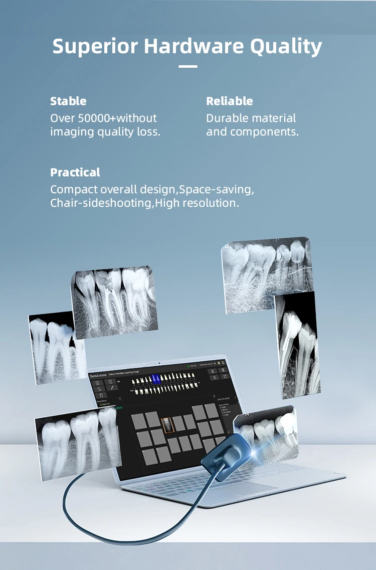 AZDENT Dental-Röntgensensor, digitales intraorales System, HD-Bild-Radiovisiograph, Röntgen-Positionierungs- und Bildgebungssystem für die Zahnmedizin – Detail 2