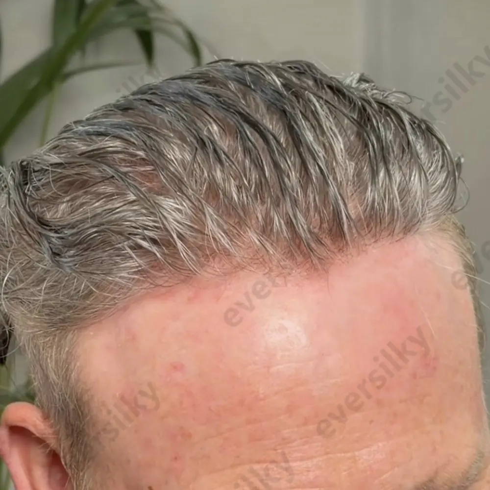 Unsichtbarer Natürlicher Haaransatz 0,02mm Ultradünnes Hauttoupet für Männer Kapillarprothese Echthaarperücken 540 # 565 # Graues Haarsystem – Detail 2