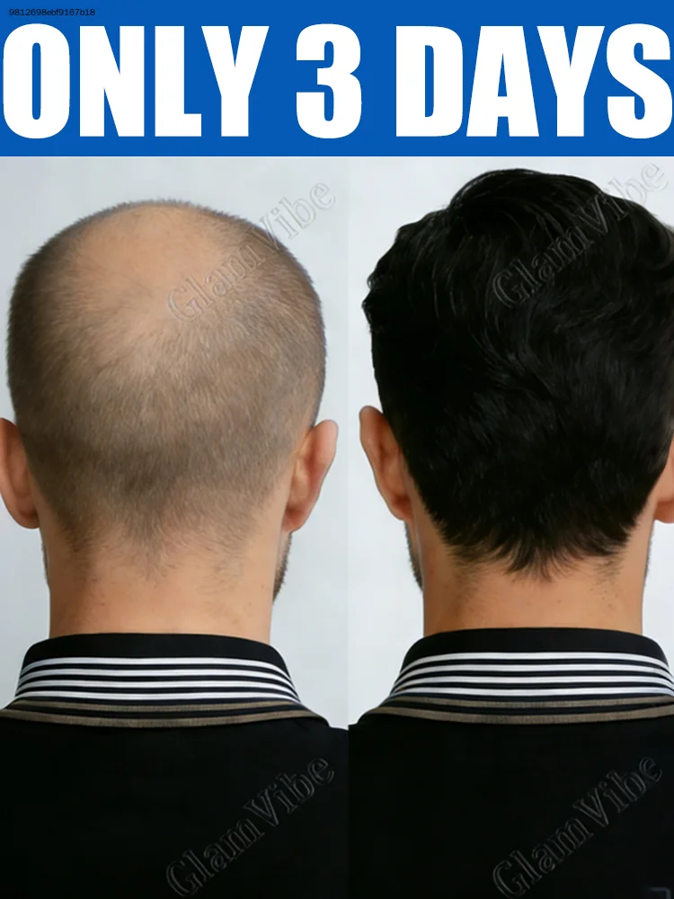 

Бесплатная доставка, быстрая доставка, ваш лучший выбор.