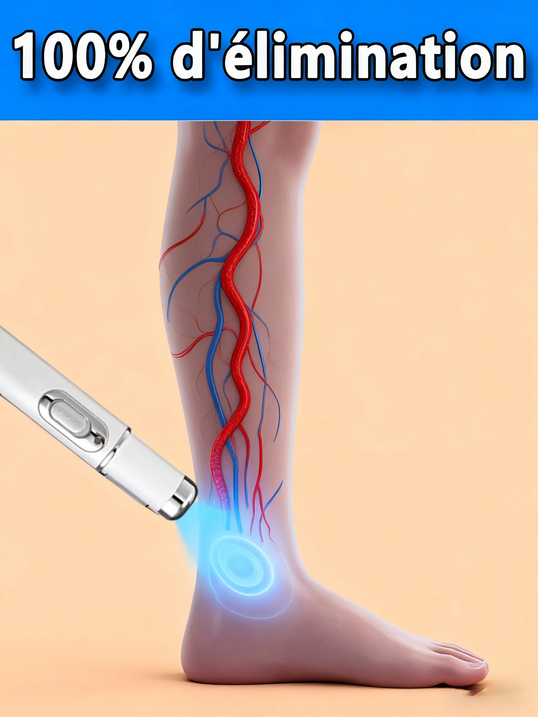 

Мини-устройство синего света от варикозного расширения вен: безболезненные инструменты для ухода за ногами, горячая распродажа в 2025 году.