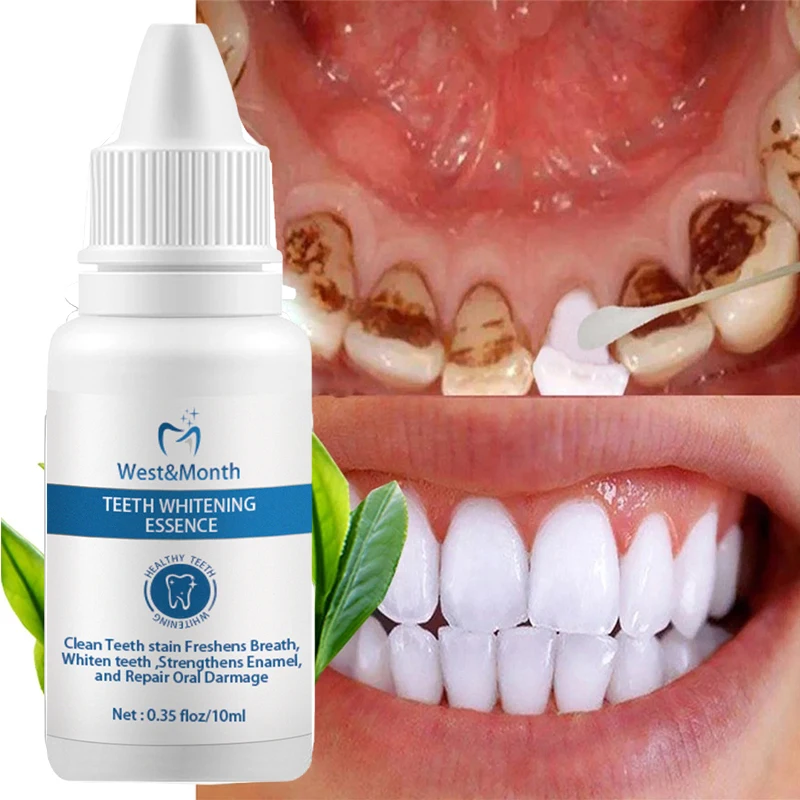 Effective Teeth Whitening Products Professional Dental Whitening Clean Smoke Coffee Stains Tartar Temoval Bleach Teeth Whitener