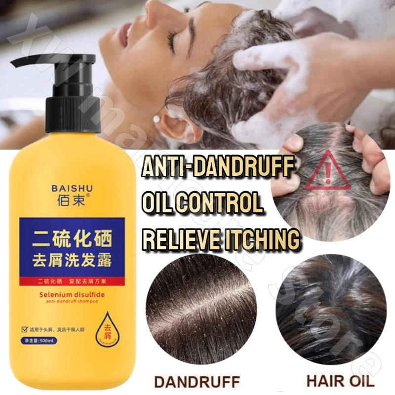 

Refreshing Anti-itch Oil Control Smooth Shampoo Deep Cleansing Hair Follicle Repair Hair Care Relieve Rough Hair Shampoo 300ml