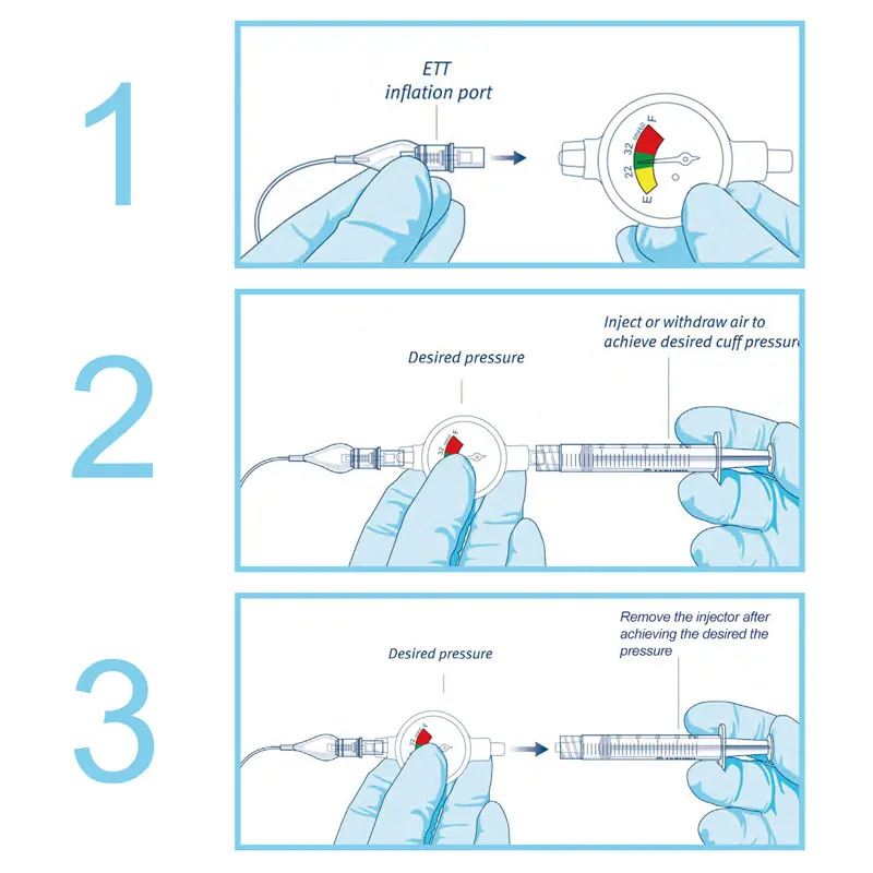 Endotracheal Intubation Air Bag Pressure Gauge Intubation Balloon Saturation Monitoring For Endotracheal Tube Veterinary Supplie