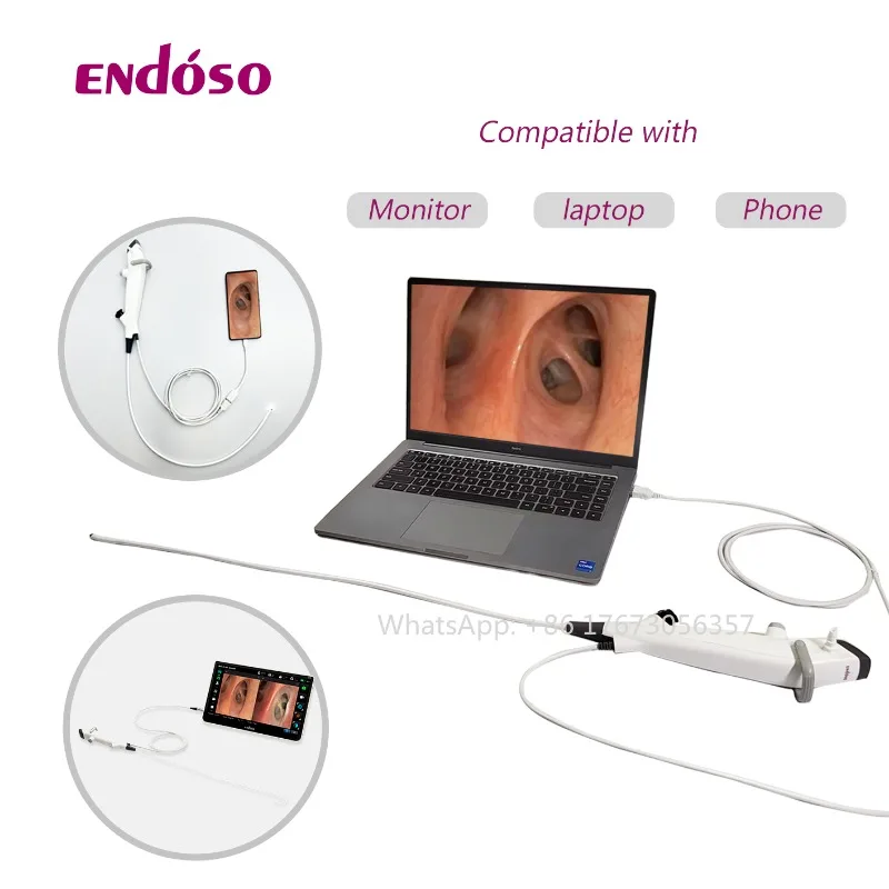 Medical Electronic Endoscope Working Channel 2.2 2.4 2.8mm  USB Connector Flexible Endoscope Video Bronchoscope Disposable ENT