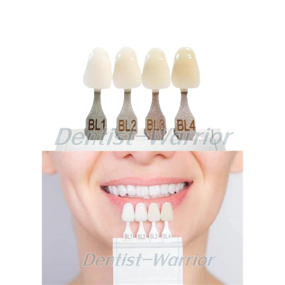 4 Colors Dental Bleached Shade Guide Bleach Chart Teeth Whitening Based Vita A-D BL1/2/3/4