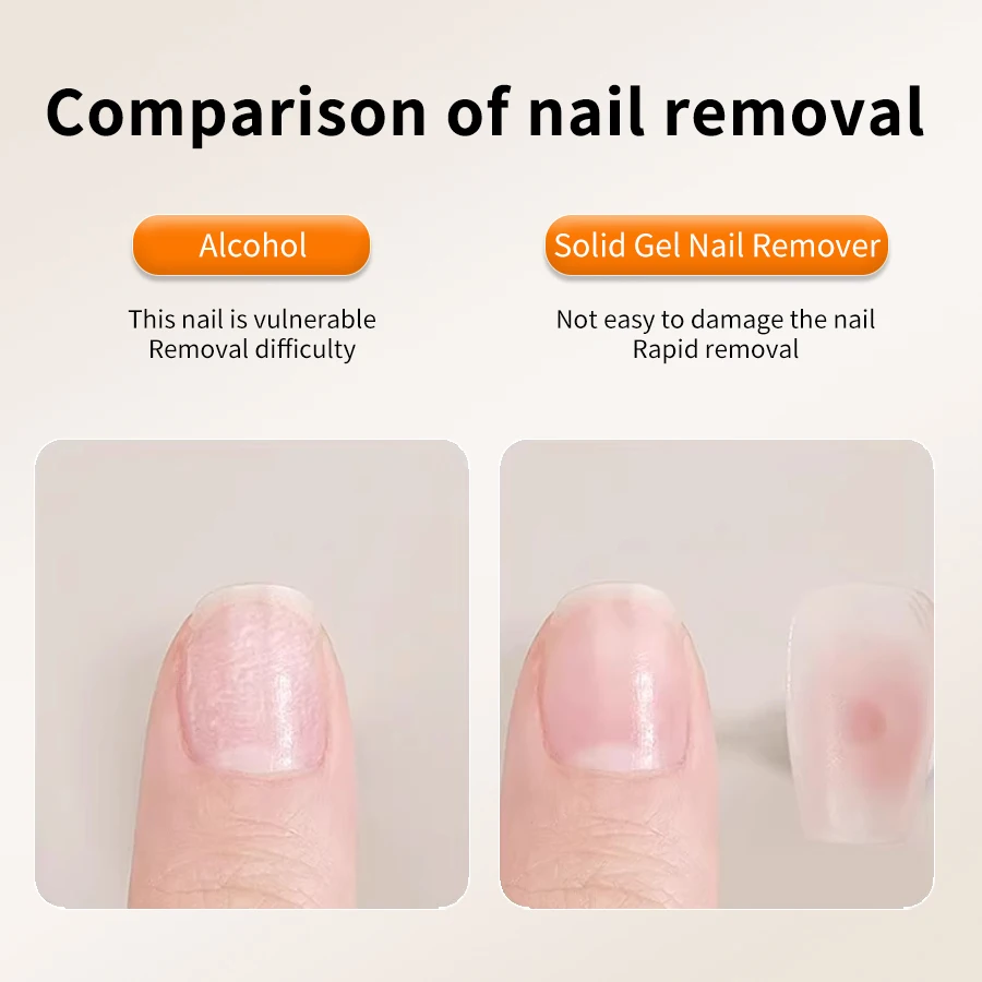 RS NAIL 15 ml Nagelkleberentferner zum Aufdrücken der Nägel. Entfernt leicht falsche Nagelspitzen. Feste Klebstoffe. Gelentferner. Festes Nagelspitzengel