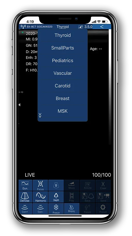 

7.5/10mhz Linear Probe Handheld sound Scanner Working With Phone Portable sound Scanner