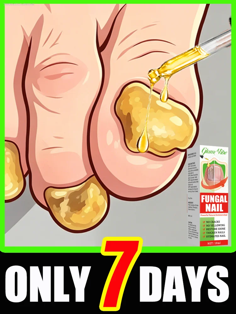 

Home-use ғᴜɴɢᴀʟ ɴᴀɪʟ ʀᴇᴘᴀɪʀ ᴏɪʟ, easy to apply, fast results