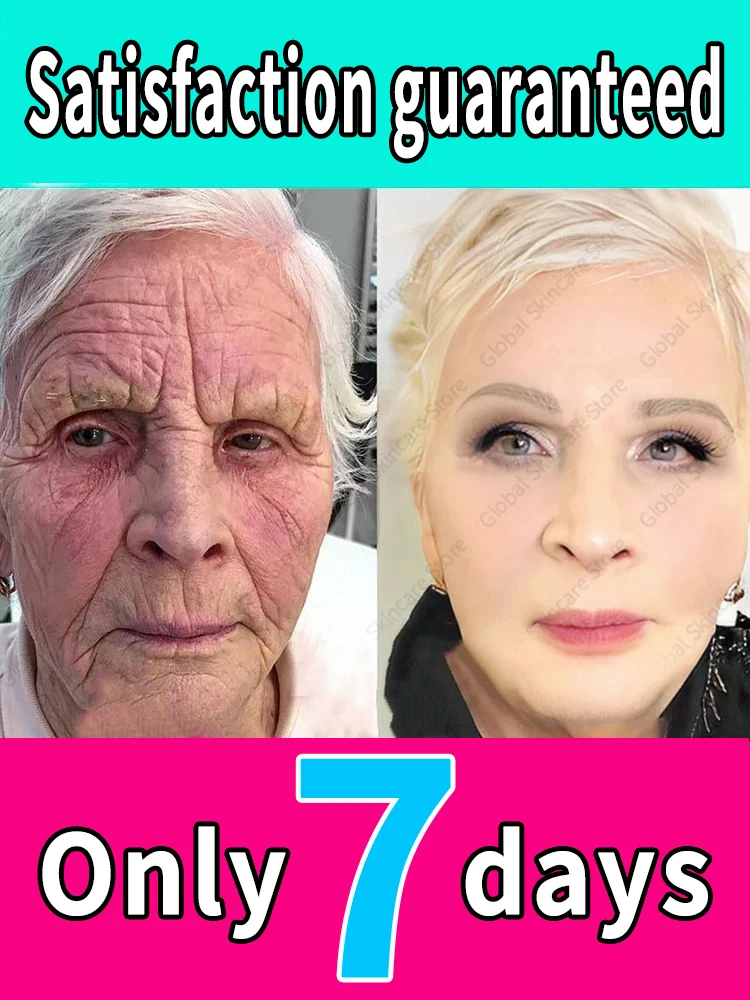 

Erase Wrinkles in Just 7 Days