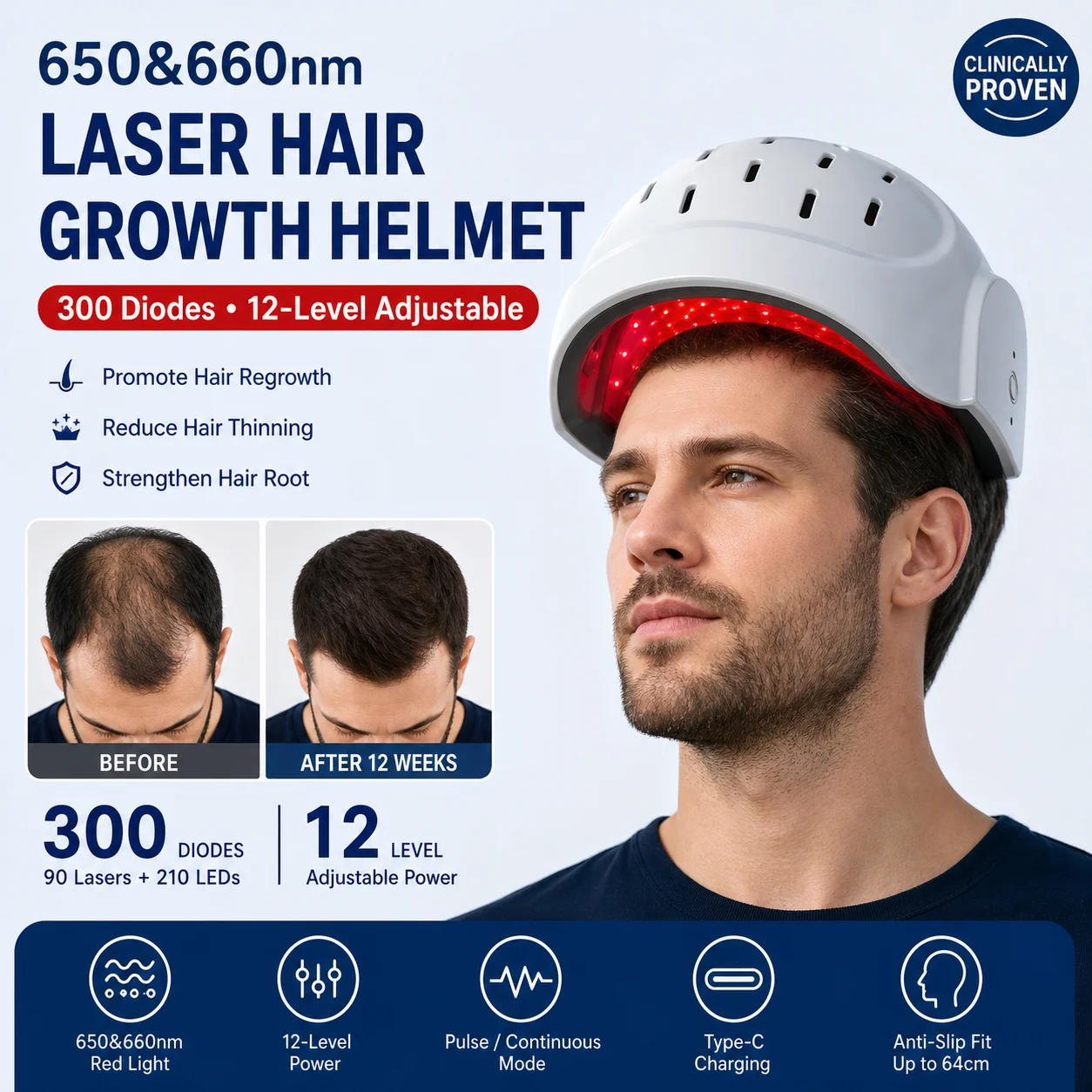 Hair Growth Cap: 300 Medical-Grade Diodes, USB Rechargeable, Wireless & Portable Design for Daily Scalp Therapy 12-Level Zone