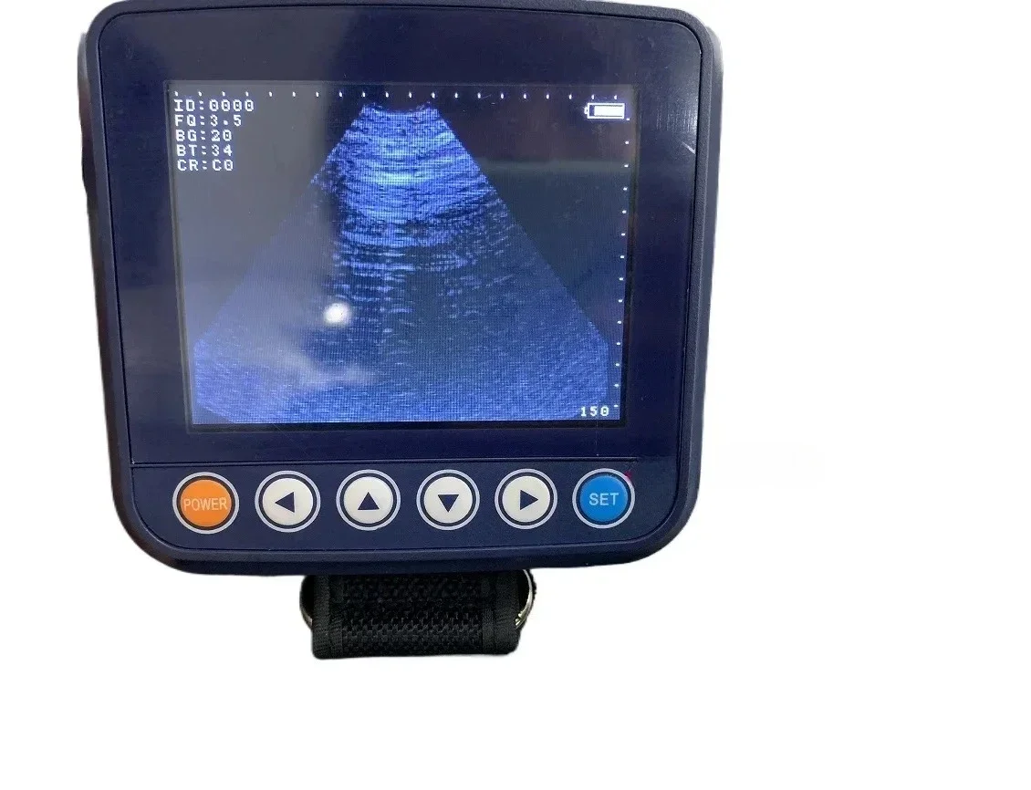 CHKJ 2025 806F الماسح الضوئي بالموجات فوق الصوتية لآلة الموجات فوق الصوتية