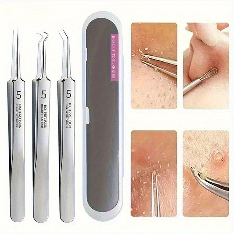 Mee-eter Clip Puistjes Pincet Mee-eter Remover Roestvrijstalen Mobiele Clip Schoonheidsproduct Acne Naald Huidreinigingsgereedschap