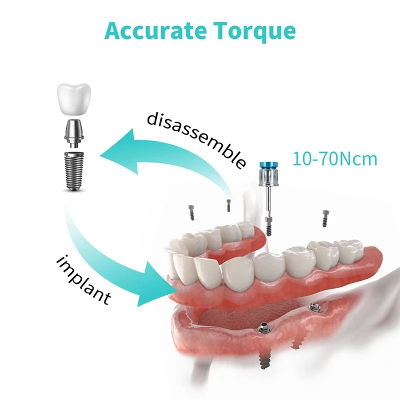 Imagem -02 - Implante Torque Protético Chave de Fenda Fixação e Remoção Kit de Restauração